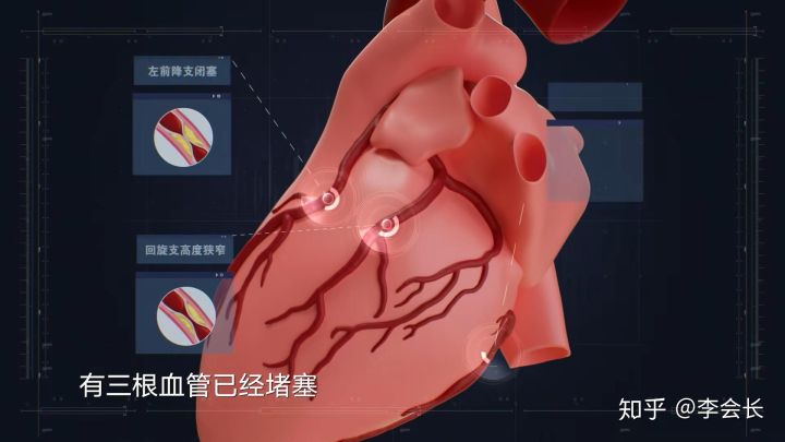 重疾險(xiǎn)