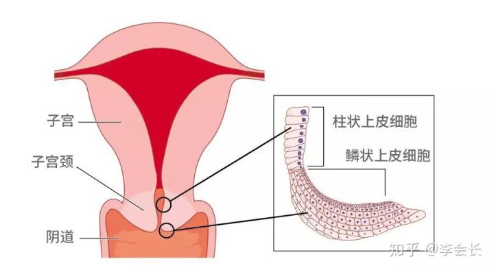 婦科疾病
