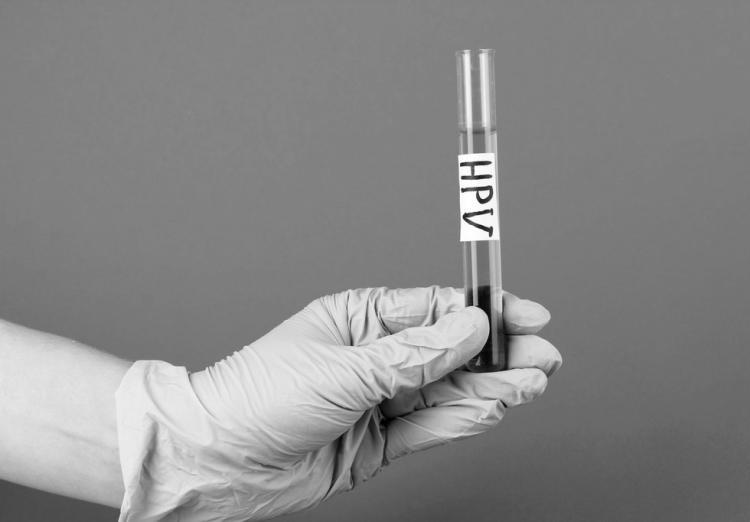 hpv陽性買重疾可以嗎？hpv是什么？