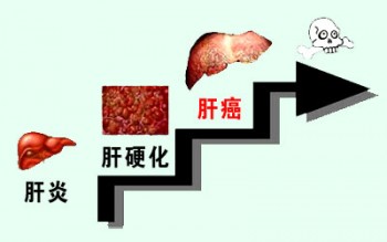 買了重疾意外死亡有得賠嗎