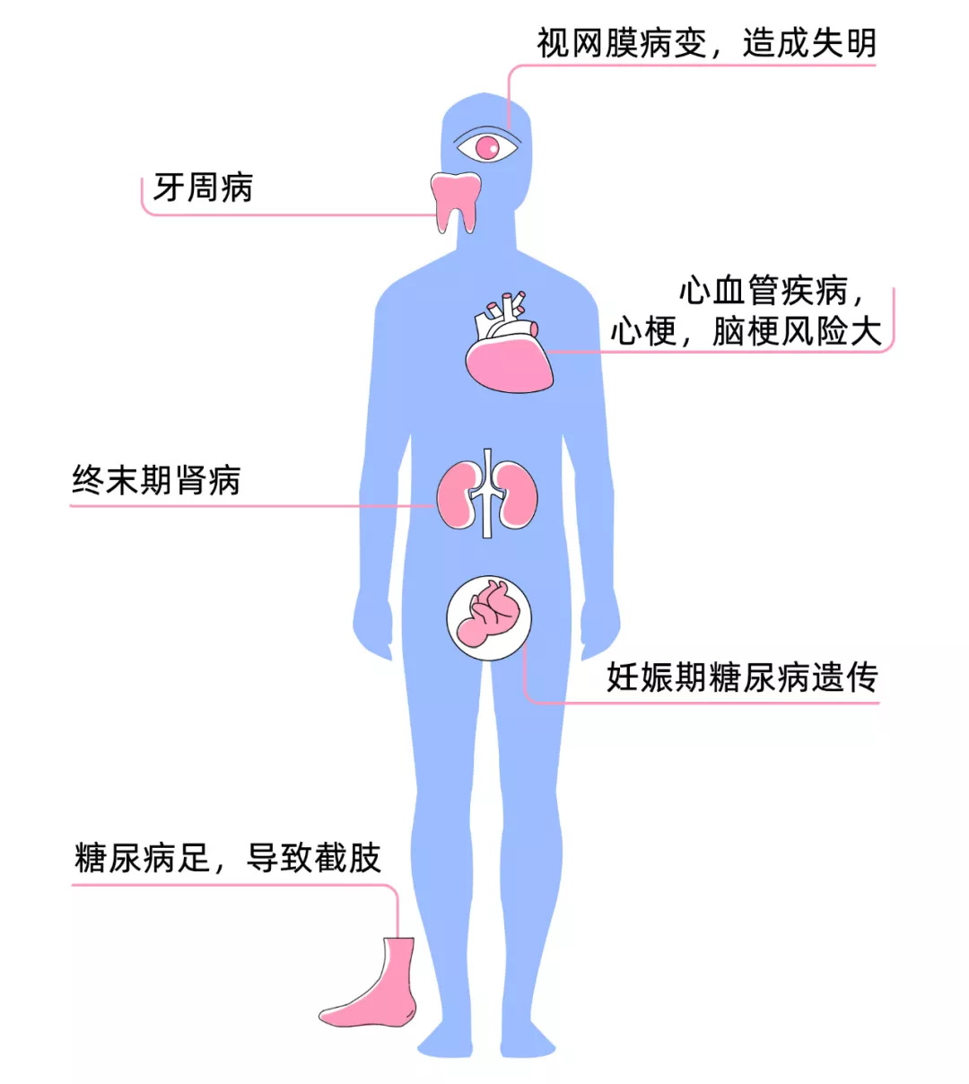 糖尿病