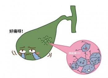 膽結(jié)石買(mǎi)保險(xiǎn)