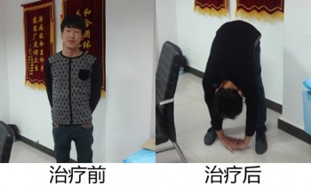 強(qiáng)直性脊柱炎可以買重疾險(xiǎn)嗎