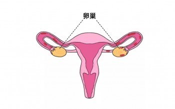 卵巢囊腫投保指南