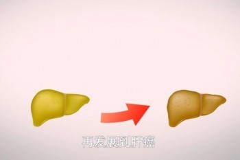 肝癌能買(mǎi)什么保險(xiǎn)？最新投保指南請(qǐng)收好