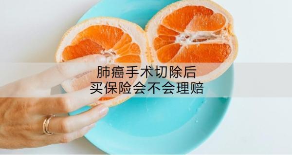 肺癌手術(shù)切除后買保險會不會理賠